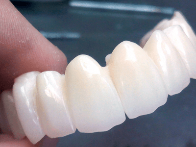 implantes dentales zirconio